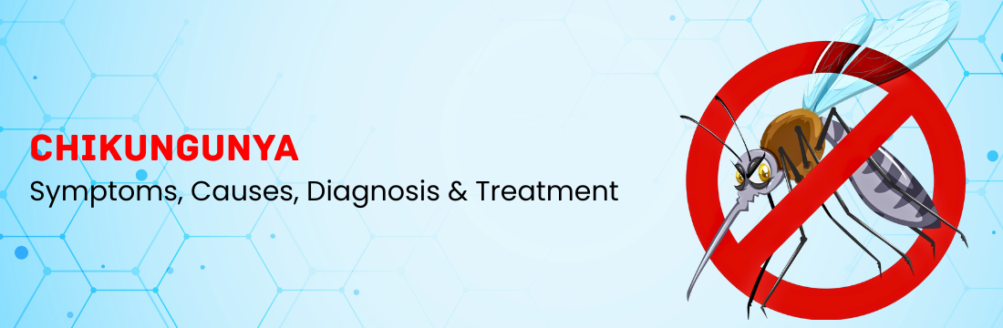 Chikungunya Symptoms: Causes, Diagnosis & Treatment